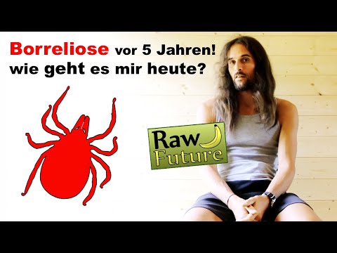 Borreliose und kein Antibiotikum - so geht es mir nach 5 Jahren! (Borreliose natürlich heilen)