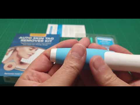 Auto Skin tag remover kit | updated large &amp; small tags review