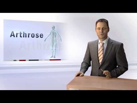Arthrose - Ursachen erkennen und heilen