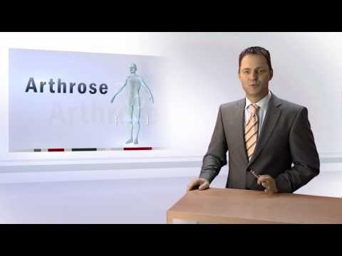 Arthrose - Ursachen erkennen und heilen