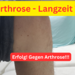 Knie Arthrose - Langzeit Traktion